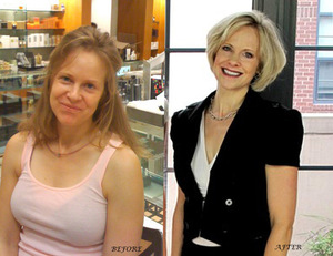 Lornabefore11-530x549_1_copy